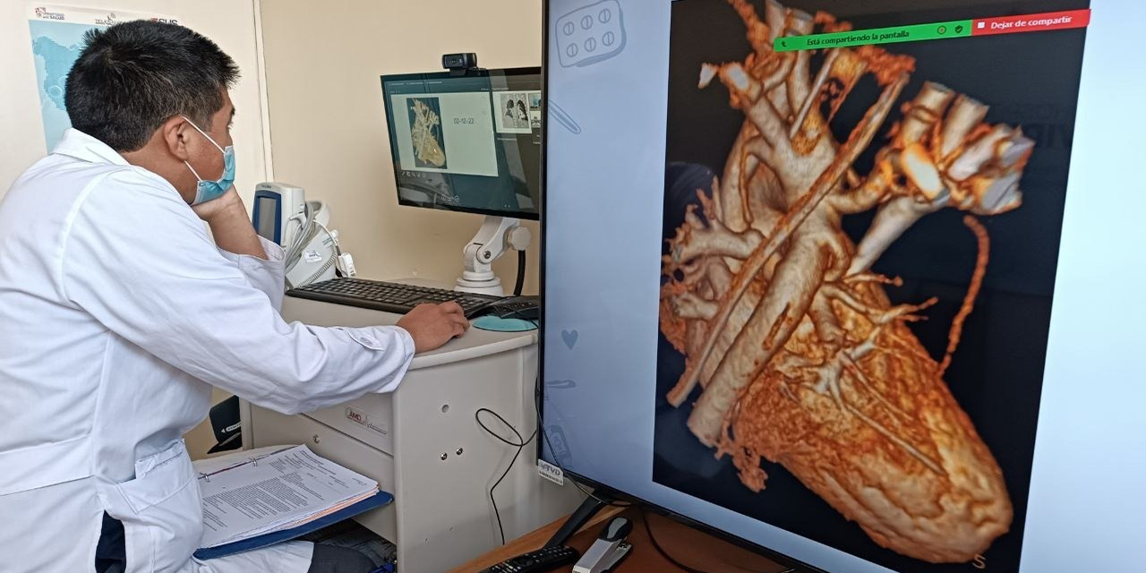 Análisis cardiológico a través de Telesalud. (Foto: Programa Telesalud) 